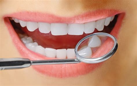 Kompozit Dolgu Nedir Nas L Yap L R Fiyat Nedir Dentium A Z Ve