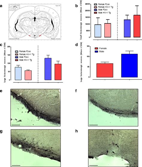 Tmn Histaminergic Neurons The Ventral Tmn Is A Small Lateral Region Of