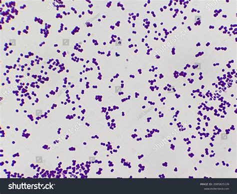 Staphylococcus Epidermidis Royalty-Free Images, Stock Photos & Pictures ...