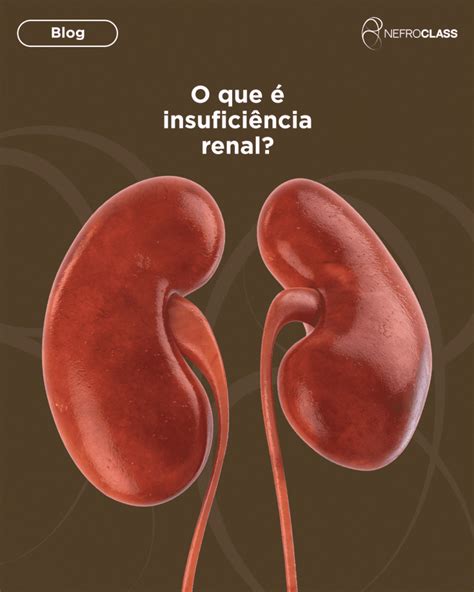 Insufici Ncia Renal O Que Causas E A Import Ncia Dos Rins