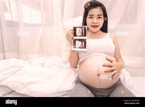 Close Up Of A Beautiful Pregnant Woman Holding An Ultrasound Scan A