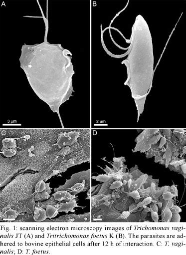 Scielo Brasil Il 10 Release By Bovine Epithelial Cells Cultured With Trichomonas Vaginalis