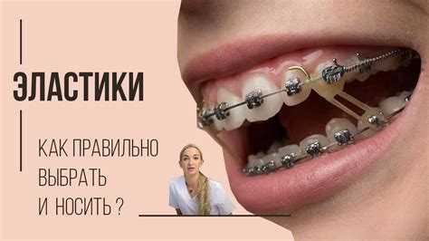 Как правильно надевать и носить эластики - YouTube