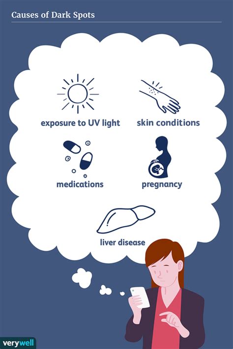 Dark Spots: Causes, Diagnosis, and Treatment