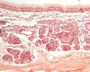 Lung Histology Labeled