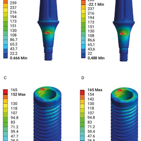 Stress Distribution In The Prosthetic Abutment And Implant σ Vm Download Scientific Diagram