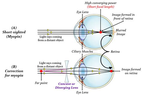 What Is The High Converging Power Of Eye Lens Tutorix