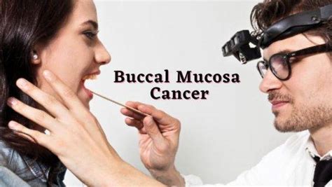 Buccal Mucosa Cancer Signs And Preventions