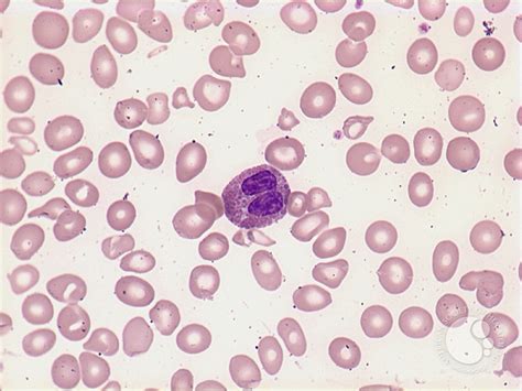 Eosinophils - 2.