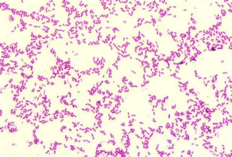 pseudomonas fluorescens gram