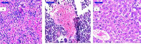 A Section From Liver Tissue Of Normal Control Group Showing Normal Download Scientific Diagram