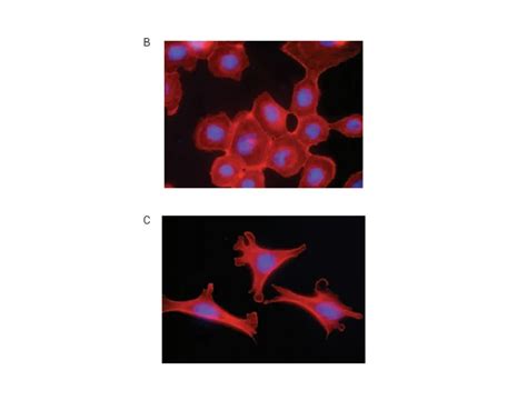 细胞动态可塑性：wntβ Catenin 如何 燎动 肿瘤 Emt ？ Medchemexpress Mce 技术前沿 资讯 生物在线