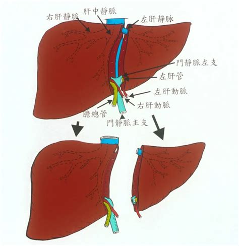 一肝救两命 青大附院儿童器官移植科成功完成两例儿童劈离式肝移植手术 澎湃号政务 澎湃新闻 The Paper