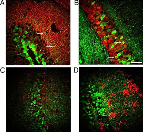 Neurons Are The Primary Cell Type Transduced By The LV GFP Vector