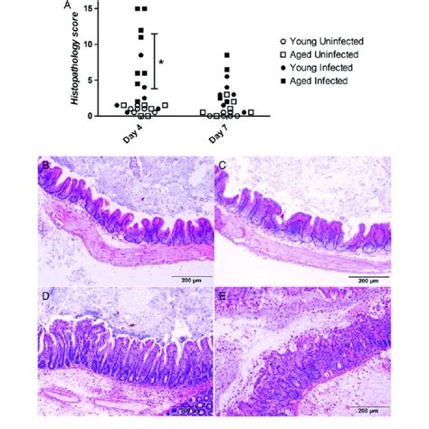 Histopathologic Analysis Of Cecal And Colonic Tissue Specimens Obtained Download Scientific