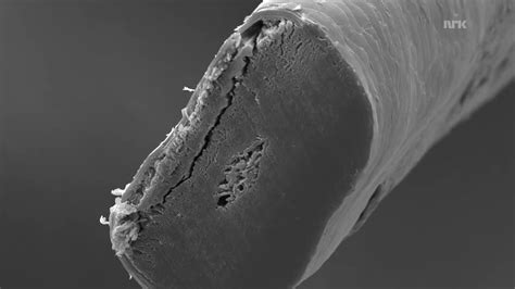 Pubertet Hår på kroppen Puberty Body hair Nude Video on YouTube nudeleted