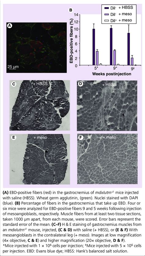 Incorporation Of Mesoangioblasts Protects Muscle Fibers From Damage As