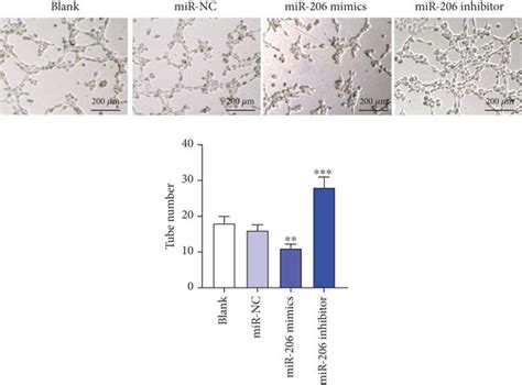 The Influence Of Mir 206 On Epc Proliferation Apoptosis Migration