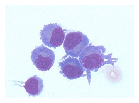 Plasmacytoid Cells Found On Cytospin Of The Cerebrospinal Fluid Download Scientific Diagram