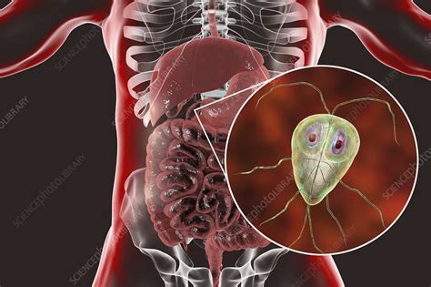 Giardia Symptoms In Humans