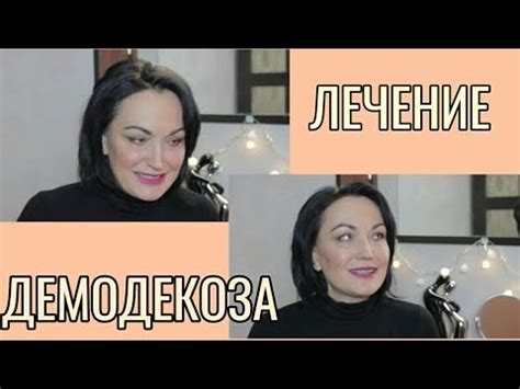 Лечение ДЕМОДЕКОЗА. Основные правила. - YouTube