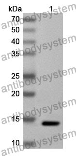 Buy Anti CD227 MUC1 Polyclonal Antibody