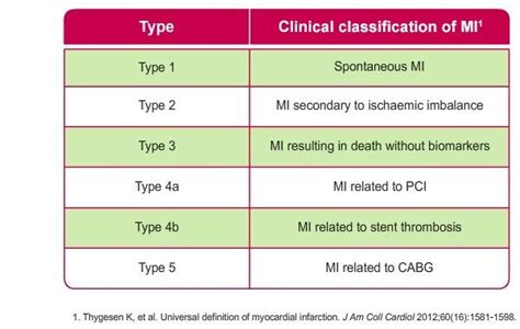 Universal Classification Of Myocardial Infarction Mi Primary Care