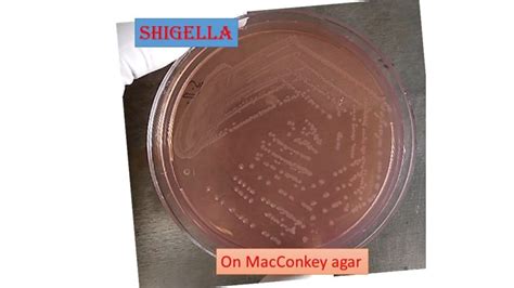 Shigella Macconkey Agar