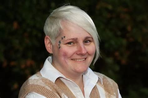 Disabled Girl Scarred For Life As Boiling Hot Water Bottle Bursts Open In Bed Mirror Online