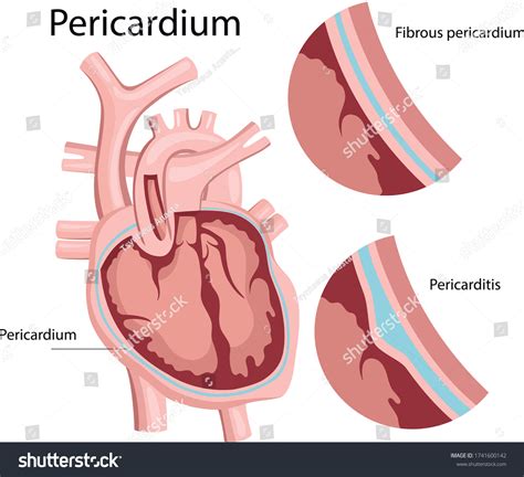 389 Pericardium Images, Stock Photos & Vectors | Shutterstock