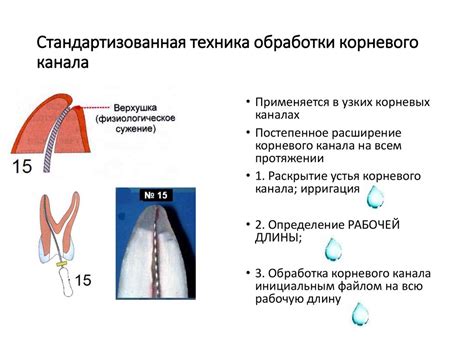 Стандартизированная методика обработки корневых каналов. Этапы ...
