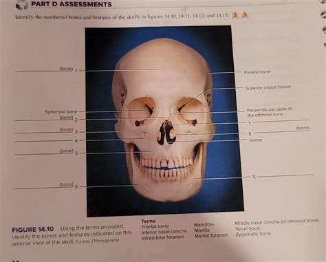 Solved Part D Assessments Identify The Numbered Bones And Chegg