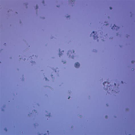 Entamoeba Histolytica Slide