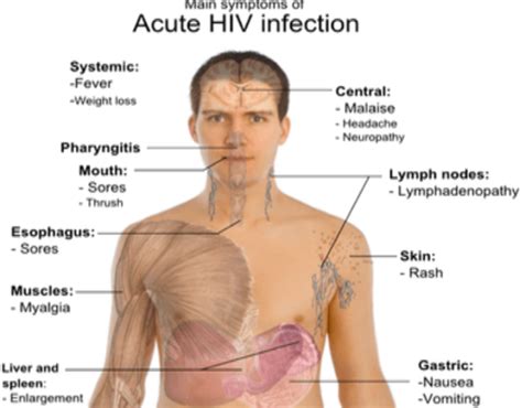 HIV Basics Flashcards Quizlet