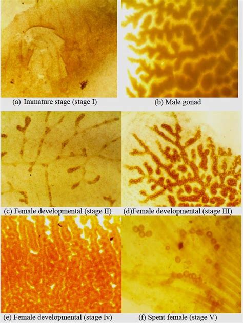 Photomicrographs Showing Gonadal Maturity Stages Of Brachidontes