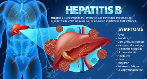 Infographie Sur Les Symptômes De Lhépatite B Vecteur Gratuite