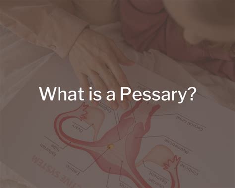 What is a Pessary? | ReConnect+ Online Streaming