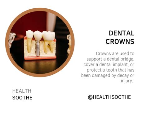 Dental Crowns