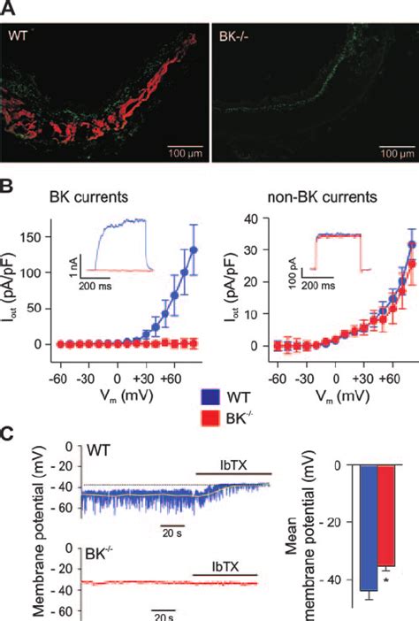 Targeted Deletion Of BK Channel Results In Membrane Depolarization Of