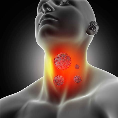 Sore Throat Pharyngitis Symptoms Causes Diagnosis And Treatment