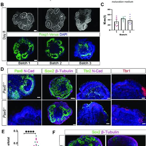 Characterisation Of Pax6 Cko Cerebral Organoids Ab Pax6 And Download Scientific Diagram