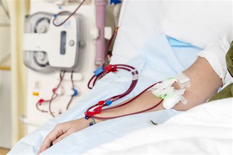 Cidp May Be Associated With Peritoneal Dialysis