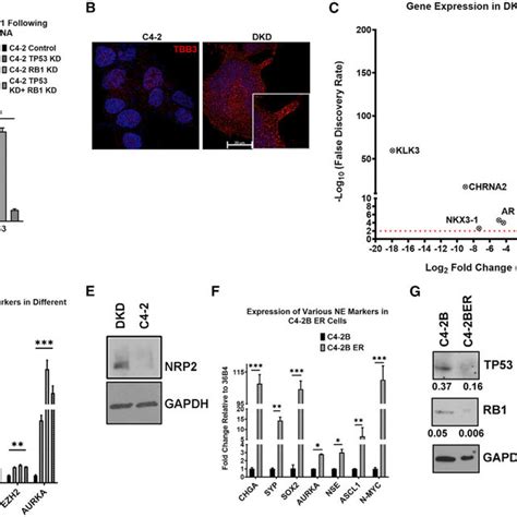 Nrp Is Highly Expressed In Human Ne Like Pca And Ar Negative Pca Mouse