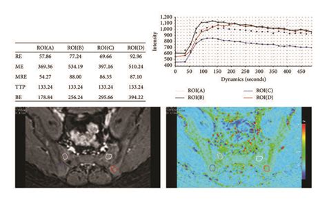 Dynamic Contrast Enhanced Magnetic Resonance Imaging Dce Mri In A