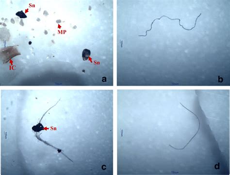 Stereo Or Dissecting Microscopy Identification Of Microplastics Solen