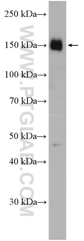 ATP7B Specific Antibody 19786 1 AP Proteintech