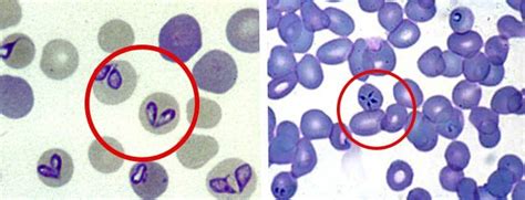 Piroplasmosis Mueveteq