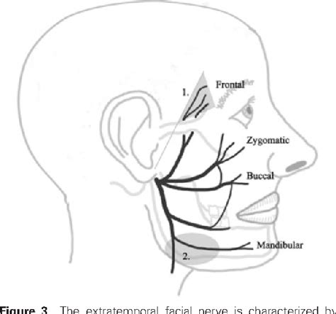 Figure 3 From A Review Of Facial Nerve Anatomy Semantic Scholar