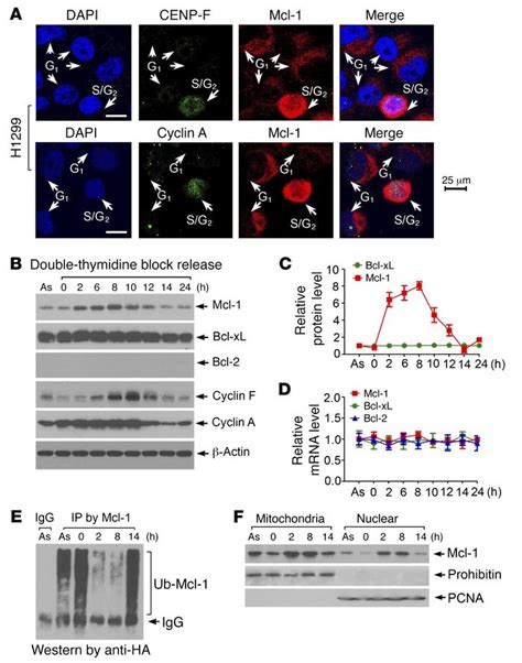 Jci Targeting Mcl 1 Enhances Dna Replication Stress Sensitivity To Cancer Therapy