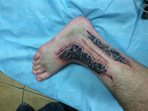 Tattoo I Got Done Around My Scar From Ankle Surgery Done By Joshua